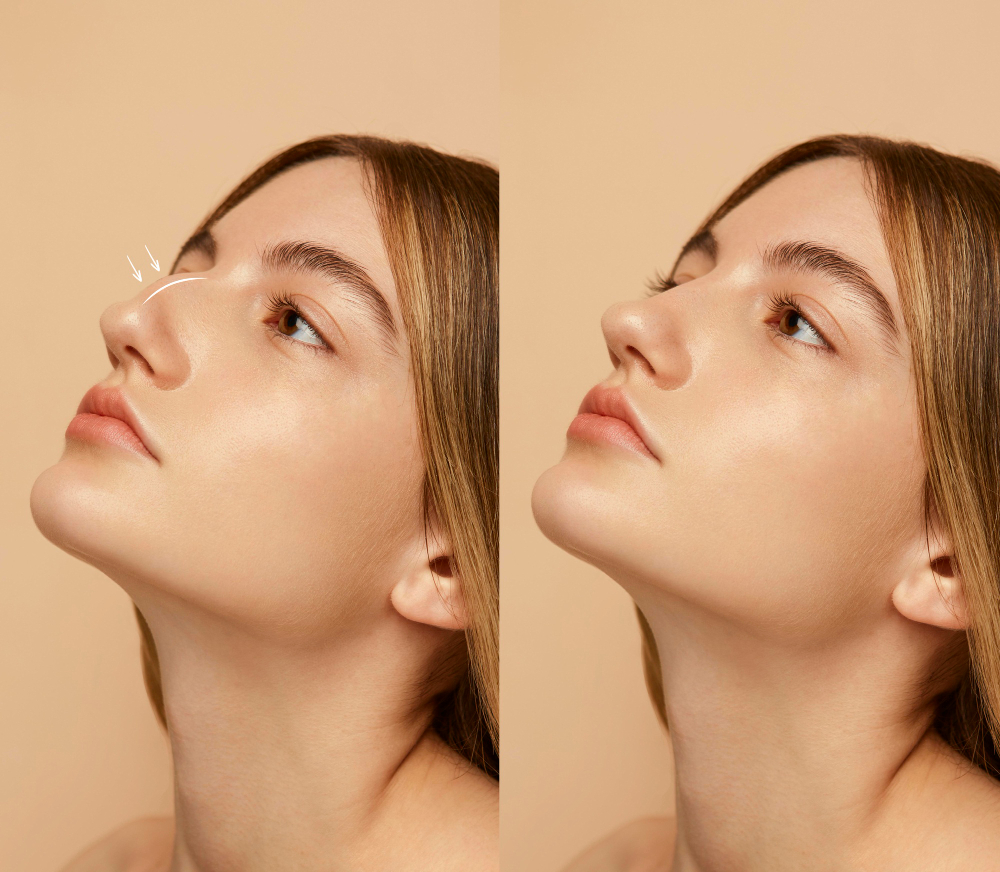 Cirugía Facial